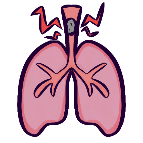 A drawing of a simplified, cartoony pair of lungs, with a generic grey object lodged in the trachea. Spiky red lines emphasize the object.